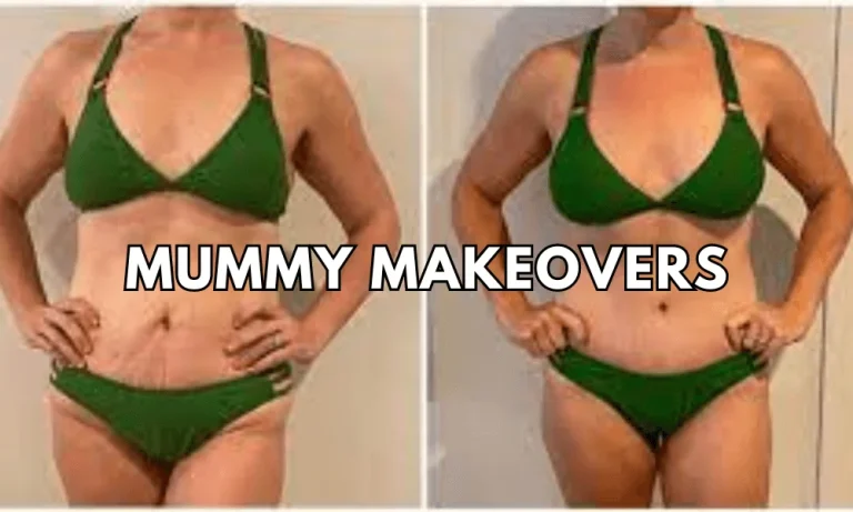 Mummy Makeovers: Transforming Your Confidence Safely and Beautifully
